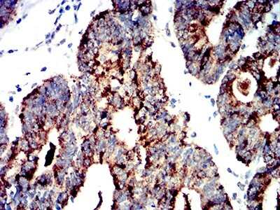Immunohistochemistry: AMPK alpha 2 Antibody (8E11H5) - BSA Free [NBP2-61852]