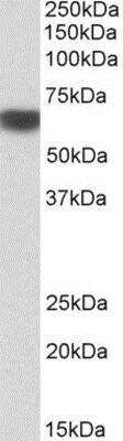 Western Blot: AMPK alpha 2 Antibody [NBP1-49859]