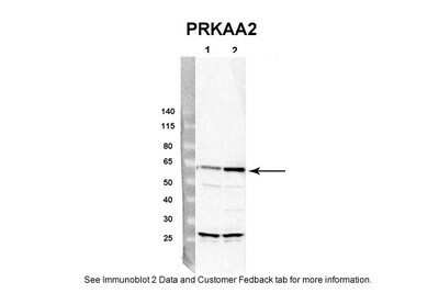Western Blot: AMPK alpha 2 Antibody [NBP1-56322]