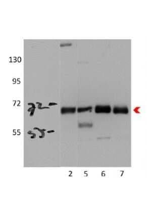 Western Blot: AMPK alpha 2 Antibody [NBP1-56322]