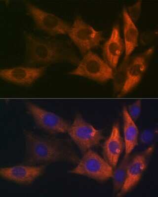 Immunocytochemistry/ Immunofluorescence: AMPK beta 1 Antibody (7G8U1) [NBP3-16380]