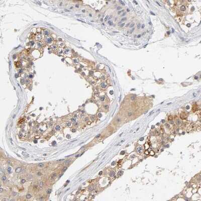 Immunohistochemistry-Paraffin: AMPK beta 1 Antibody [NBP1-87487]