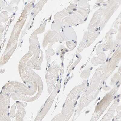 Immunohistochemistry-Paraffin: AMPK beta 1 Antibody [NBP1-87487]