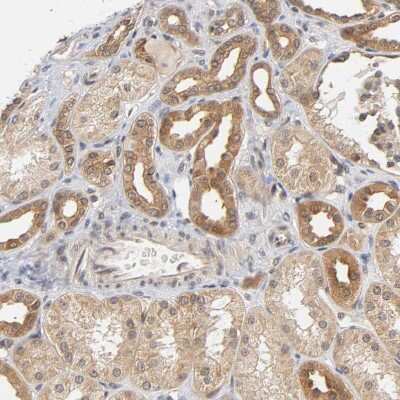 Immunohistochemistry-Paraffin: AMPK beta 1 Antibody [NBP1-87487]