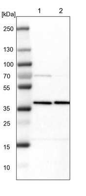 Western Blot: AMPK beta 1 Antibody [NBP1-87487]