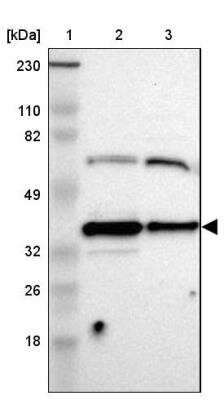 Western Blot: AMPK beta 1 Antibody [NBP1-87487]