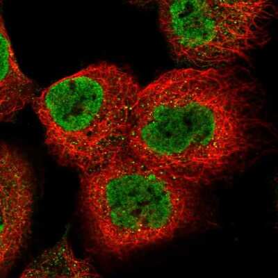 Immunocytochemistry/ Immunofluorescence: AMPK beta 2/PRKAB2 Antibody [NBP1-92286]