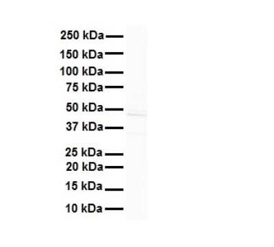 Western Blot: AMSH-LP Antibody [NBP2-86993]