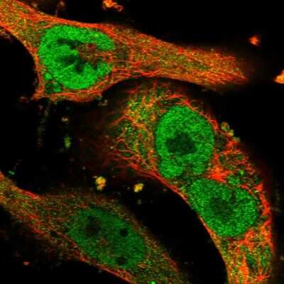 Immunocytochemistry/ Immunofluorescence: AMSH/STAMBP Antibody [NBP1-90172]