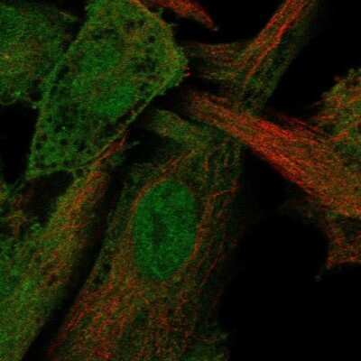 Immunocytochemistry/ Immunofluorescence: AMSH/STAMBP Antibody [NBP2-68627]