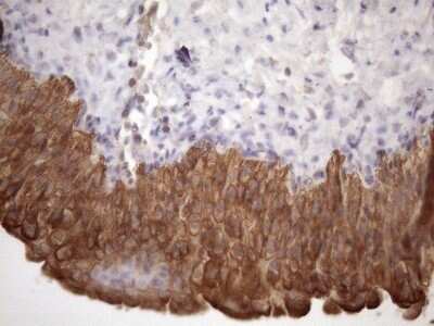 Immunohistochemistry: AMTN Antibody (OTI2D9) [NBP2-46517]