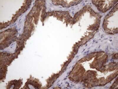 Immunohistochemistry: AMTN Antibody (OTI2D9) [NBP2-46517]