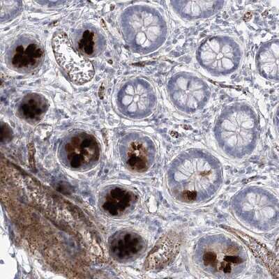 Immunohistochemistry-Paraffin: AMTN Antibody [NBP2-32718]