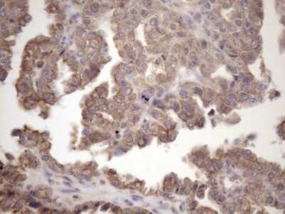 Immunohistochemistry: AMTN Antibody (OTI2D9) - Azide and BSA Free [NBP2-72507]