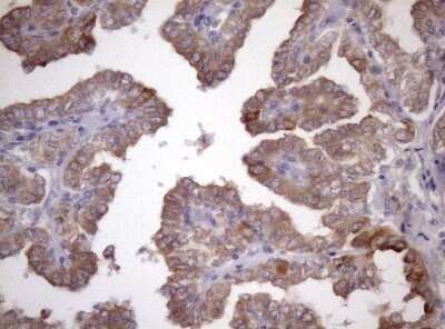 Immunohistochemistry: AMTN Antibody (OTI2D9) - Azide and BSA Free [NBP2-72507]