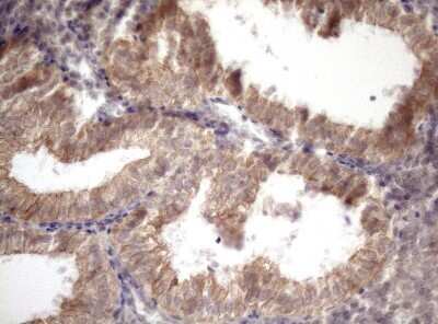 Immunohistochemistry: AMTN Antibody (OTI2D9) - Azide and BSA Free [NBP2-72507]
