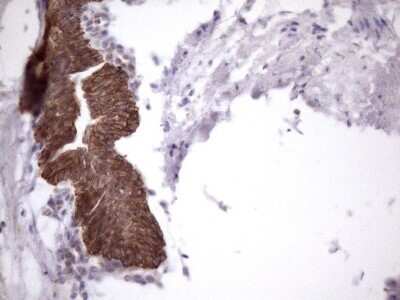 Immunohistochemistry: AMTN Antibody (OTI2D9) - Azide and BSA Free [NBP2-72507]