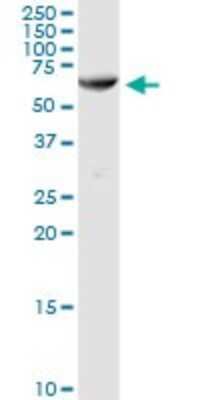 Western Blot: AMY1C Antibody [H00000278-D01P]