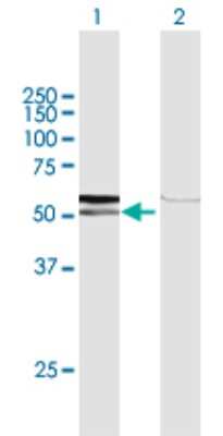Western Blot: AMY1C Antibody [H00000278-D01P]