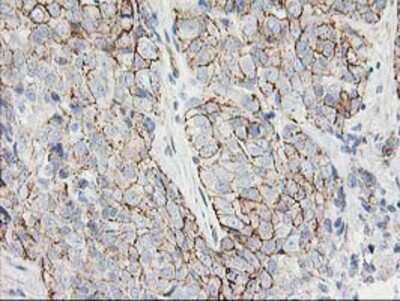 Immunohistochemistry-Paraffin: ANAPC2 Antibody (OTI1A6) [NBP2-01128]