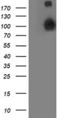 Western Blot: ANAPC2 Antibody (OTI1A6) [NBP2-01128]