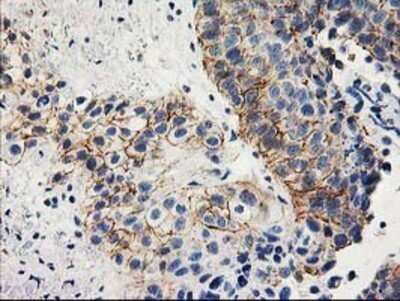 Immunohistochemistry: ANAPC2 Antibody (OTI1A6) - Azide and BSA Free [NBP2-71860]