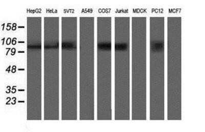 Western Blot: ANAPC2 Antibody (OTI1A6)Azide and BSA Free [NBP2-71860]