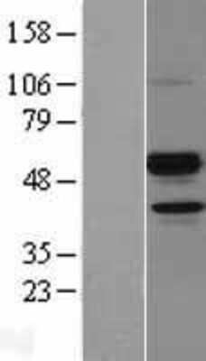 Western Blot: Angiopoietin-like Protein 7/ANGPTL7 Overexpression Lysate [NBL1-07529]