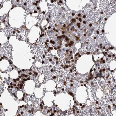 Immunohistochemistry-Paraffin: ANKDD1A Antibody [NBP1-91667]