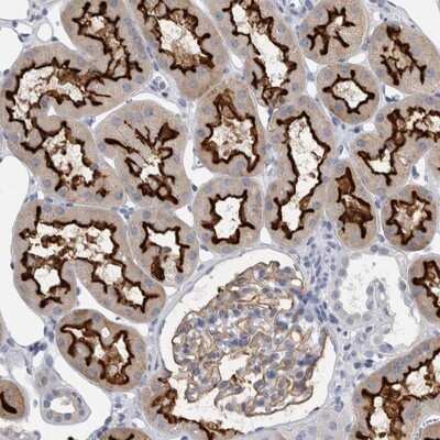 Immunohistochemistry-Paraffin: ANKFY1 Antibody [NBP1-89085]