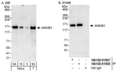 Western Blot: ANKIB1 Antibody [NB100-61608]
