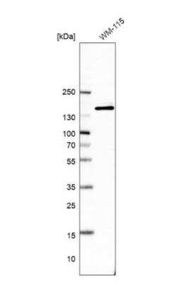 Western Blot: ANKIB1 Antibody [NBP2-47548]