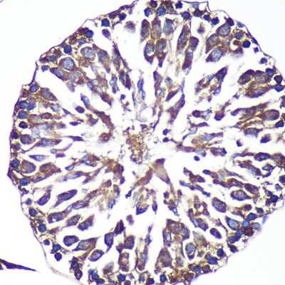 Immunohistochemistry-Paraffin: ANKLE2 Antibody - Azide and BSA Free [NBP2-92367]