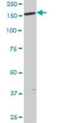 Western Blot: ANKMY1 Antibody [H00051281-B01P]