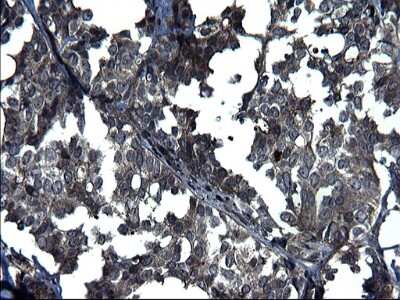 Immunohistochemistry: ANKMY2 Antibody (OTI1F11) [NBP2-46524]