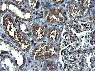 Immunohistochemistry: ANKMY2 Antibody (OTI1F11) [NBP2-46524]