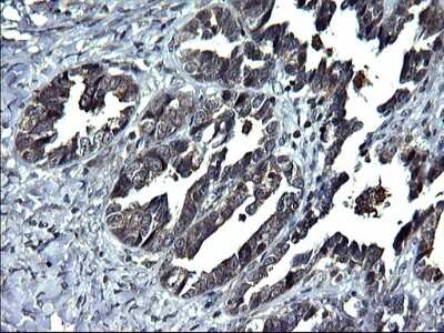 Immunohistochemistry: ANKMY2 Antibody (OTI1F11) [NBP2-46524]