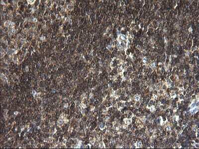 Immunohistochemistry: ANKMY2 Antibody (OTI1F11) [NBP2-46524]