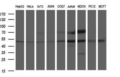 Western Blot: ANKMY2 Antibody (OTI1F11) [NBP2-46524]