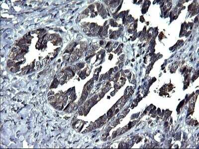 Immunohistochemistry: ANKMY2 Antibody (OTI1F11) - Azide and BSA Free [NBP2-72073]
