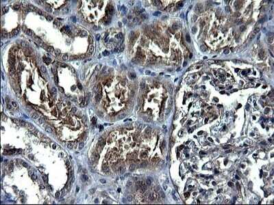 Immunohistochemistry: ANKMY2 Antibody (OTI1F11) - Azide and BSA Free [NBP2-72073]