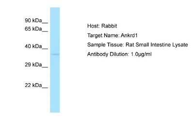 Western Blot: ANKRD1 Antibody [NBP1-98324]