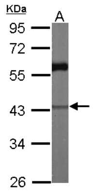 Western Blot: ANKRD1 Antibody [NBP2-15397]