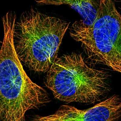 Immunocytochemistry/ Immunofluorescence: ANKRD10 Antibody [NBP2-37891]