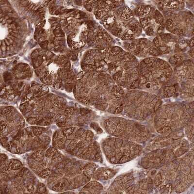 Immunohistochemistry: ANKRD10 Antibody [NBP2-37891]