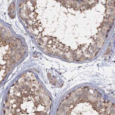 Immunohistochemistry-Paraffin: ANKRD13A Antibody [NBP1-89082]