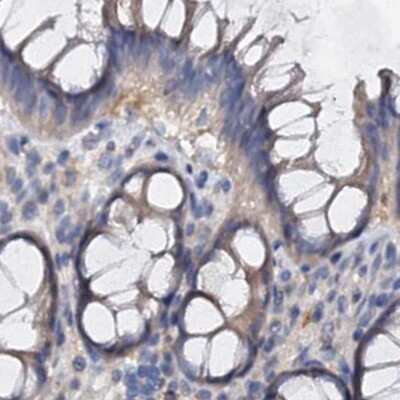 Immunohistochemistry-Paraffin: ANKRD13A Antibody [NBP1-89082]