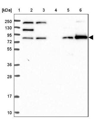 Western Blot: ANKRD13A Antibody [NBP2-38505]