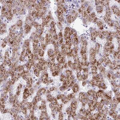 Immunohistochemistry-Paraffin: ANKRD13B Antibody [NBP2-14293]