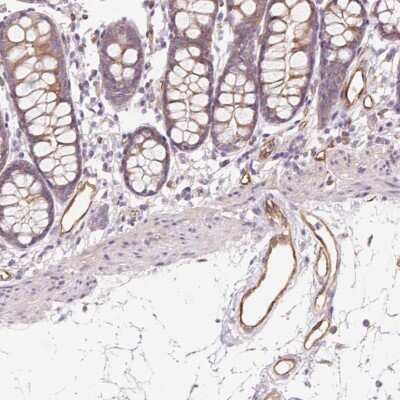 Immunohistochemistry-Paraffin: ANKRD13B Antibody [NBP2-49404]